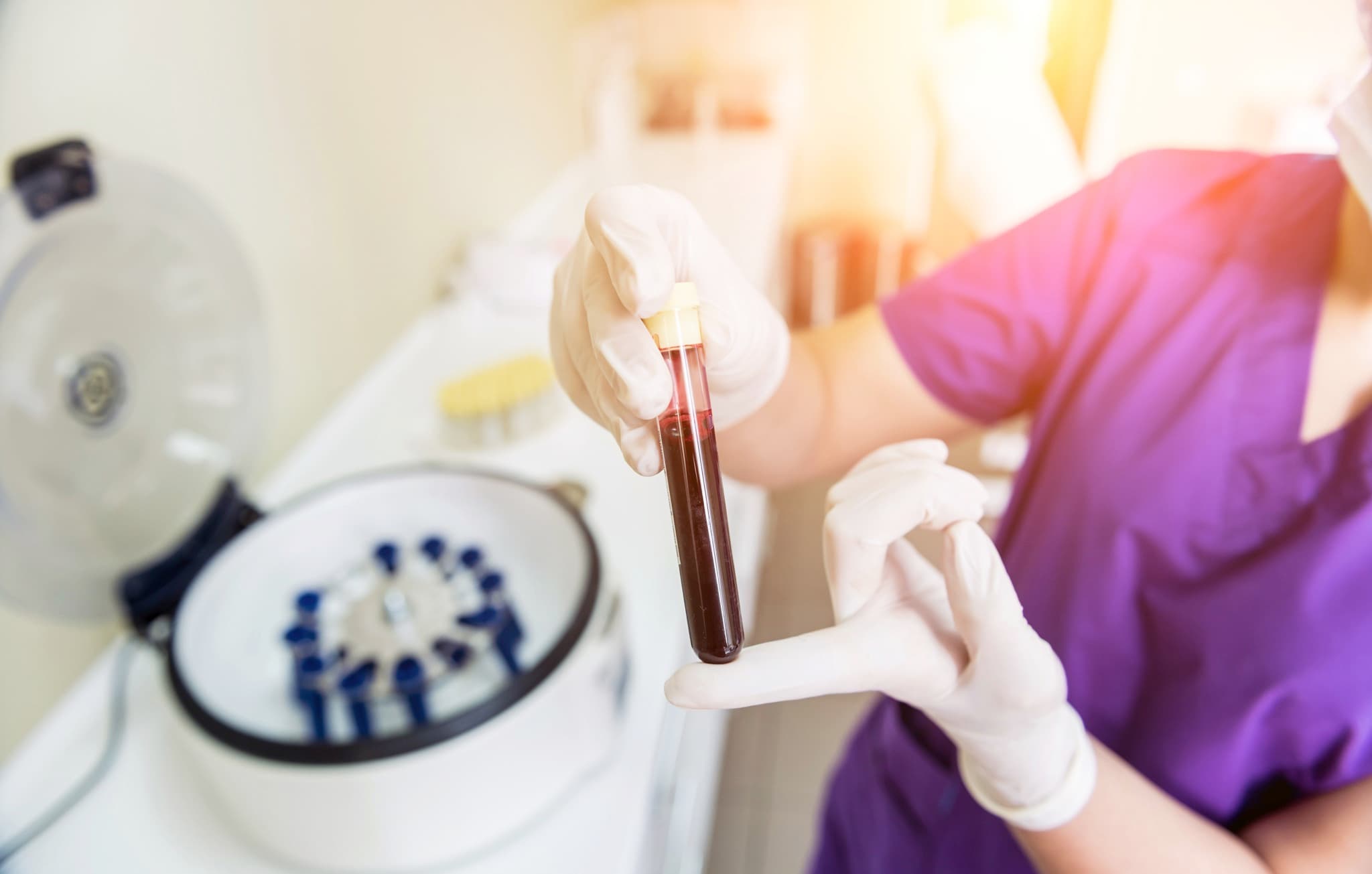 Lab technician holding PRP blood tube by centrifuge